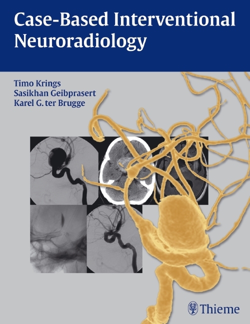 Case-Based Interventional Neuroradiology main product photo