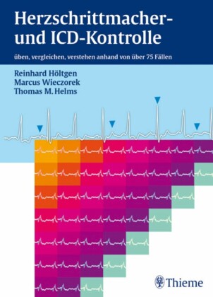 Herzschrittmacher- und ICD-Kontrolle