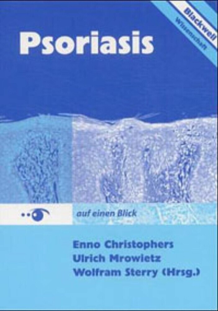 Psoriasis auf einen Blick 3894125470 main product photo