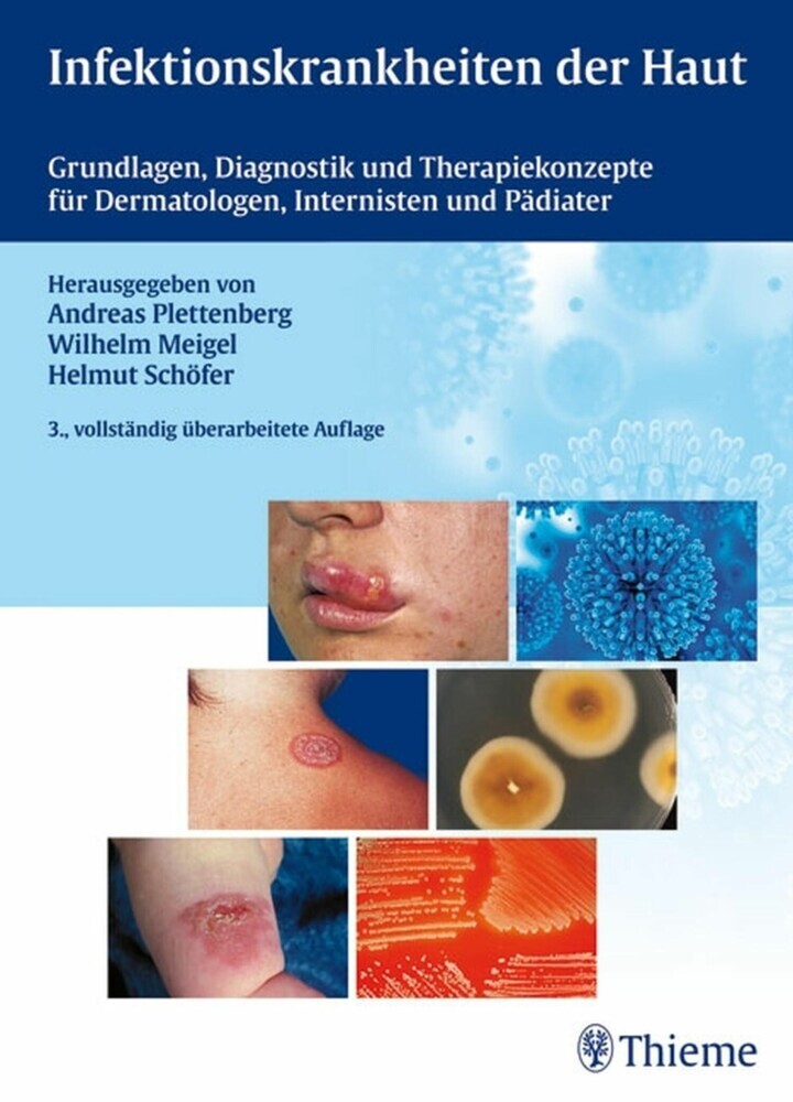 Infektionskrankheiten der Haut main product photo