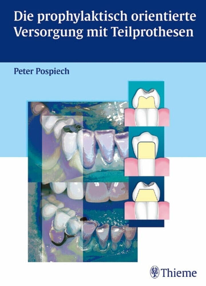 Die prophylaktisch orientierte Versorgung mit Teilprothesen main product photo