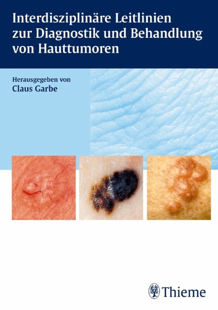 Interdisziplinäre Leitlinien zur Diagnostik und Behandlung von Hauttumoren main product photo