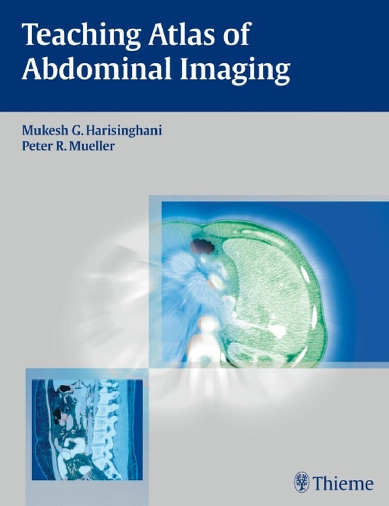 Teaching Atlas of Abdominal Imaging main product photo