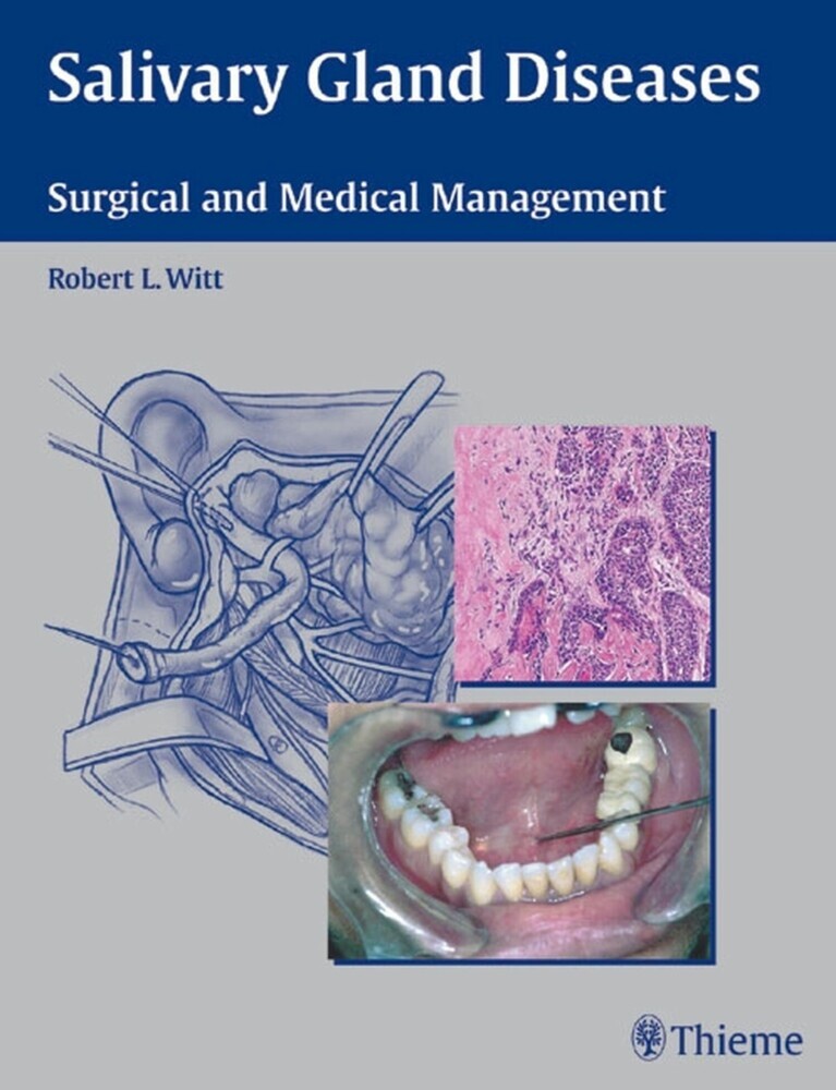Salivary Gland Diseases main product photo