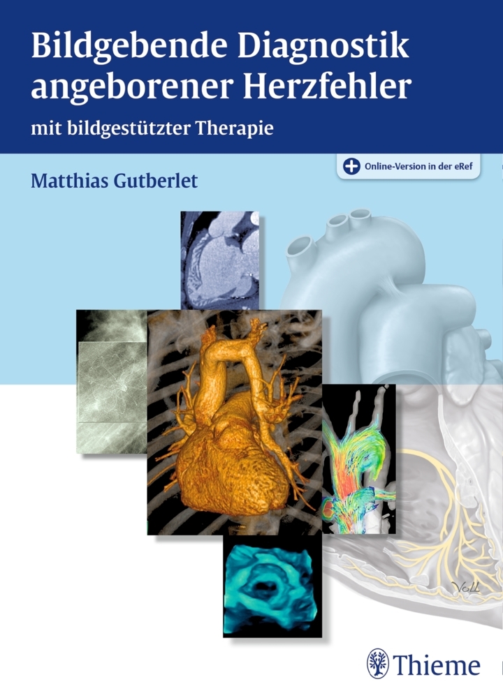 Bildgebende Diagnostik angeborener Herzfehler main product photo