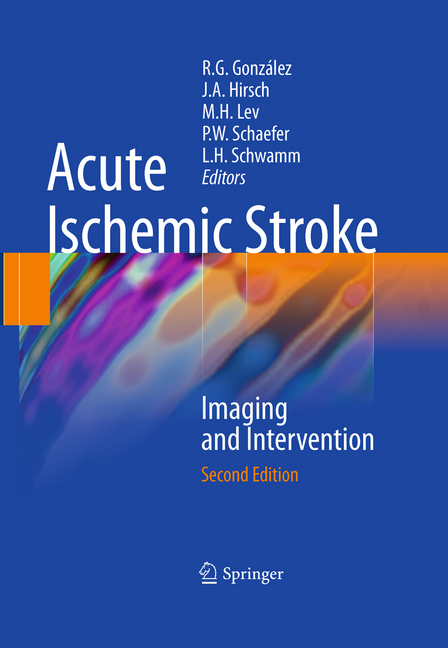Acute Ischemic Stroke main product photo