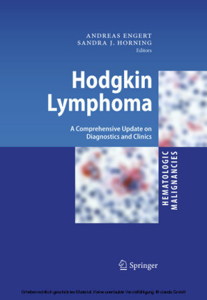 Hodgkin Lymphoma