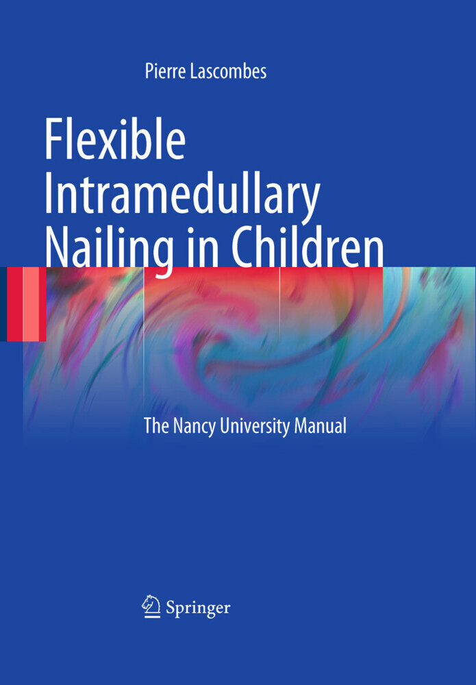 Flexible Intramedullary Nailing in Children main product photo