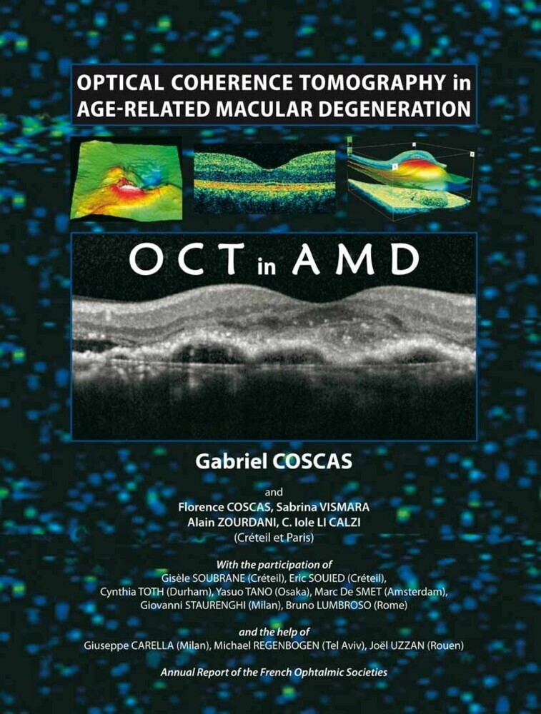 Optical Coherence Tomography in Age-Related Macular Degeneration main product photo