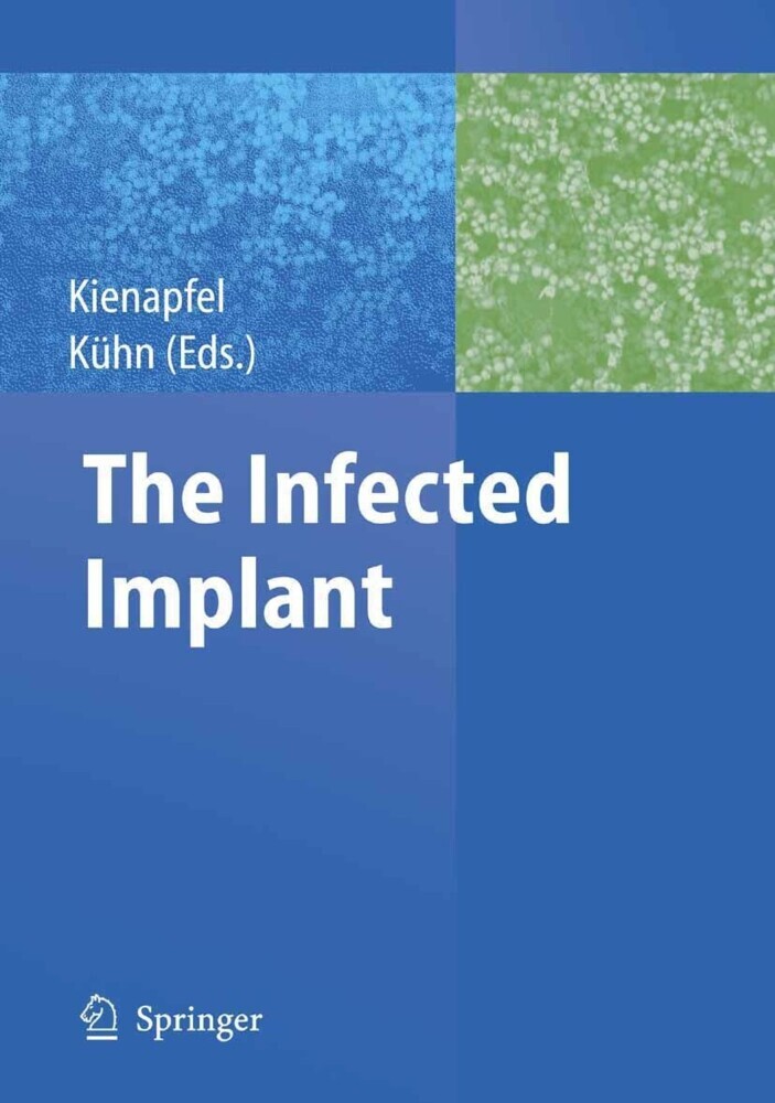 The Infected Implant main product photo