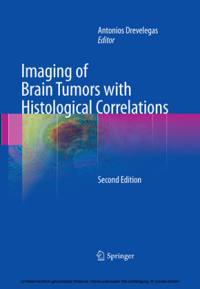 Imaging of Brain Tumors with Histological Correlations