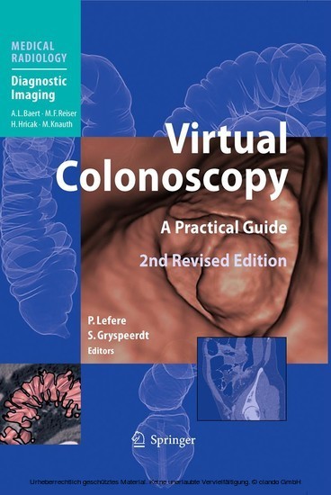 Virtual Colonoscopy main product photo