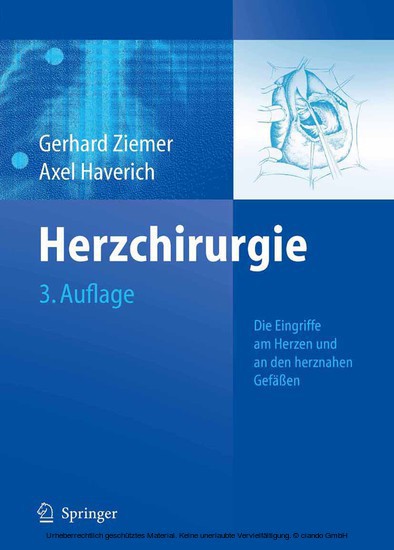 Herzchirurgie main product photo