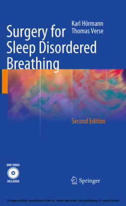 Surgery for Sleep Disordered Breathing