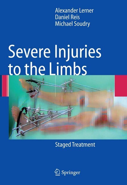 Severe Injuries to the Limbs main product photo