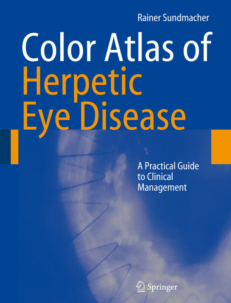 Color Atlas of Herpetic Eye Disease main product photo