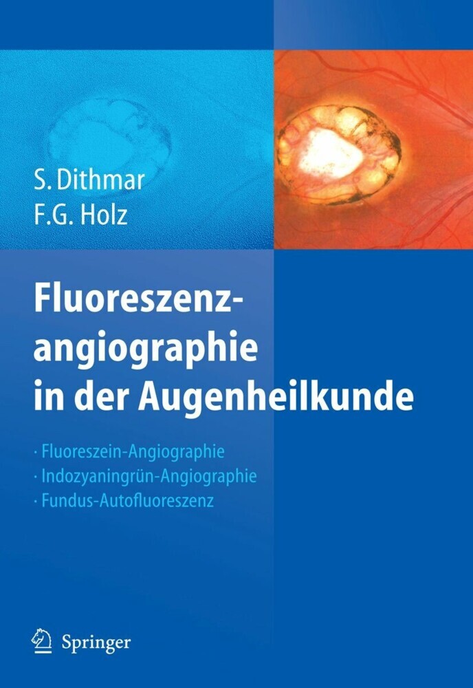 Fluoreszenzangiographie in der Augenheilkunde main product photo
