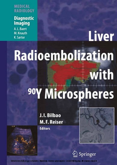 Liver Radioembolization with 90Y Microspheres main product photo