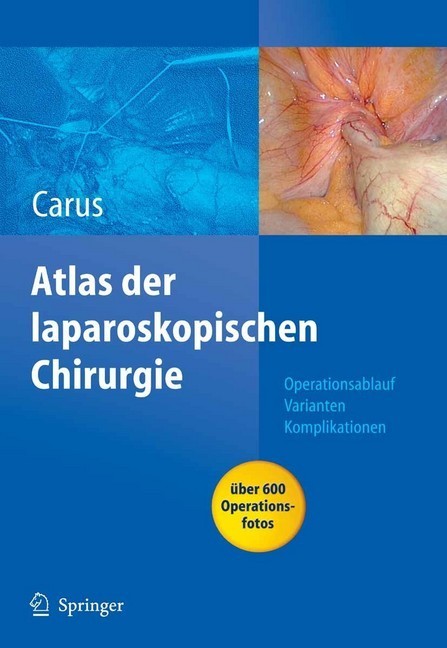Operationsatlas Laparoskopische Chirurgie main product photo