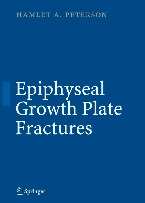 Epiphyseal Growth Plate Fractures main product photo