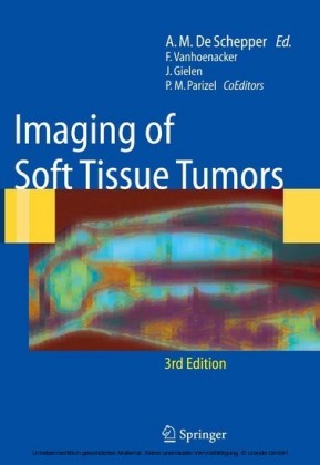 Imaging of Soft Tissue Tumors