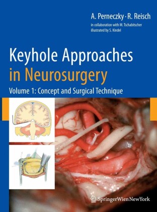 Keyhole Approaches in Neurosurgery. Vol.1