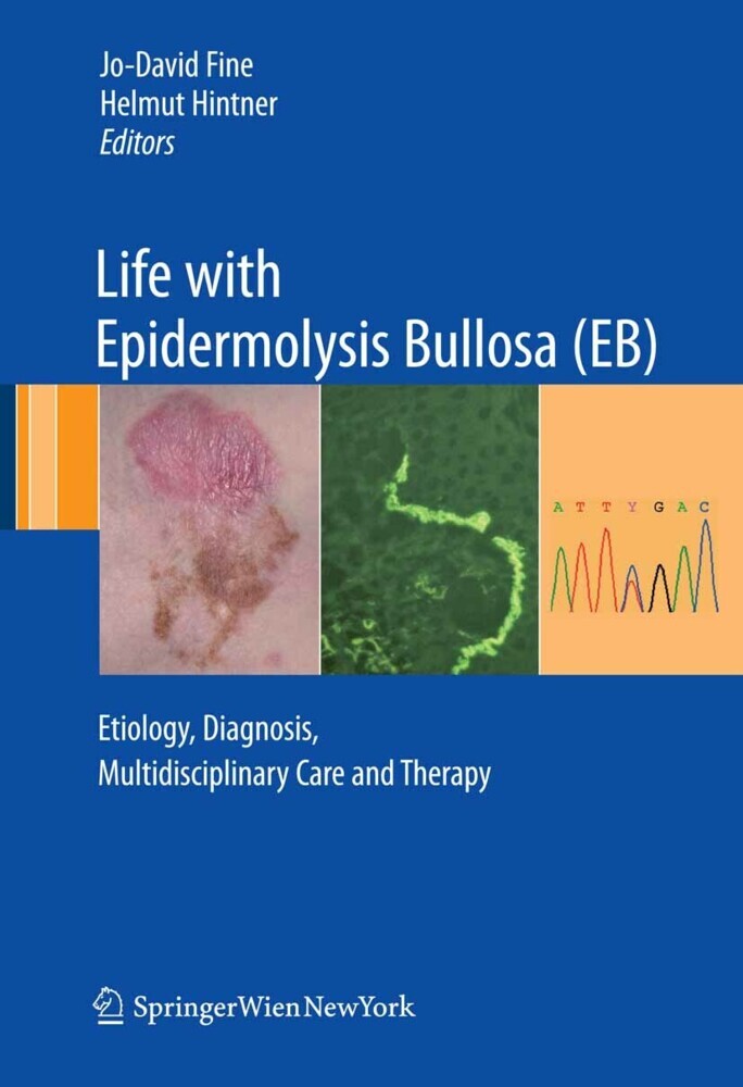 Life with Epidermolysis Bullosa (EB) main product photo