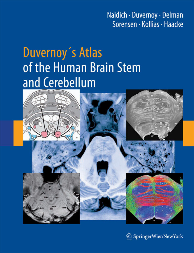 Duvernoy's Atlas of the Human Brain Stem and Cerebellum main product photo