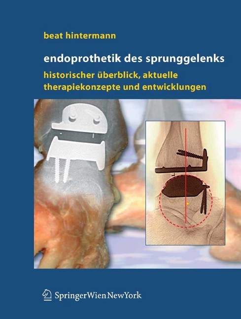 Endoprothetik des Sprunggelenks main product photo