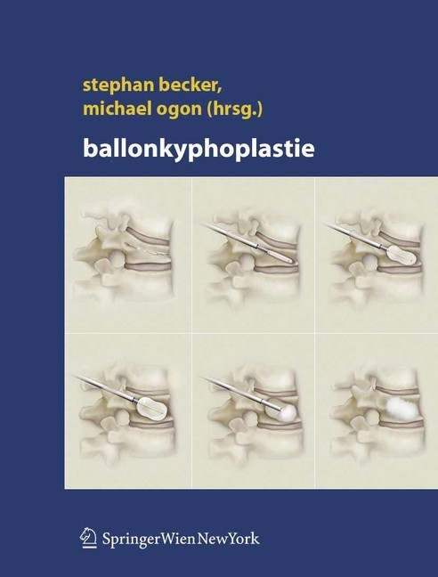 Ballonkyphoplastie main product photo