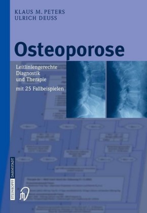 Osteoporose