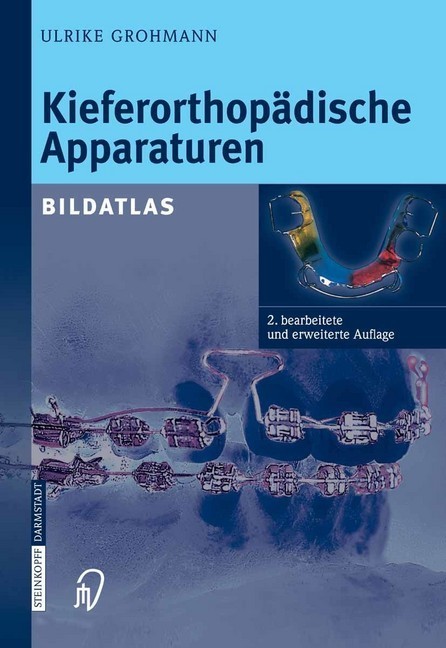 Kieferorthopädische Apparaturen main product photo