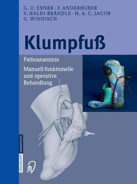 Klumpfuß main product photo