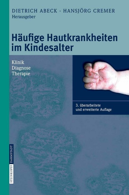 Häufige Hautkrankheiten im Kindesalter main product photo