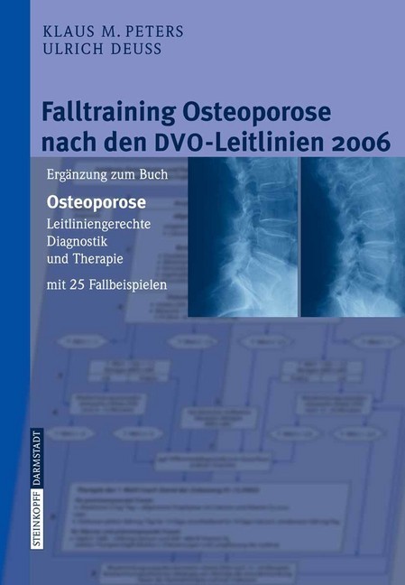 Falltraining Osteoporose nach den DVO-Leitlinien 2006 main product photo