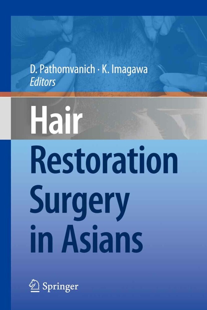 Hair Restoration Surgery in Asians main product photo