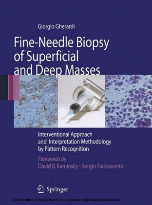 Fine-Needle Biopsy of Superficial and Deep Masses