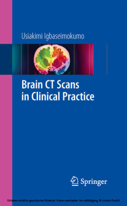 Brain CT Scans in Clinical Practice