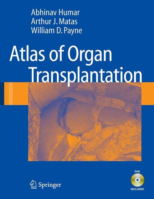 Atlas of Organ Transplantation main product photo