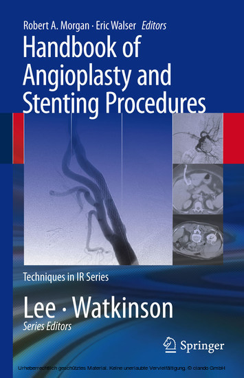 Handbook of Angioplasty and Stenting Procedures main product photo