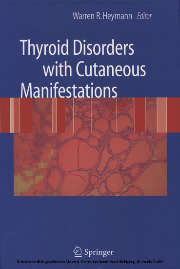 Thyroid Disorders with Cutaneous Manifestations main product photo
