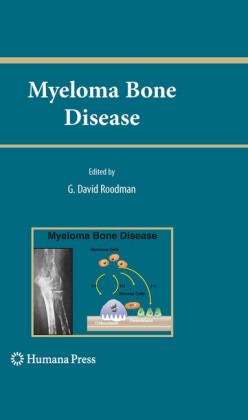 Myeloma Bone Disease