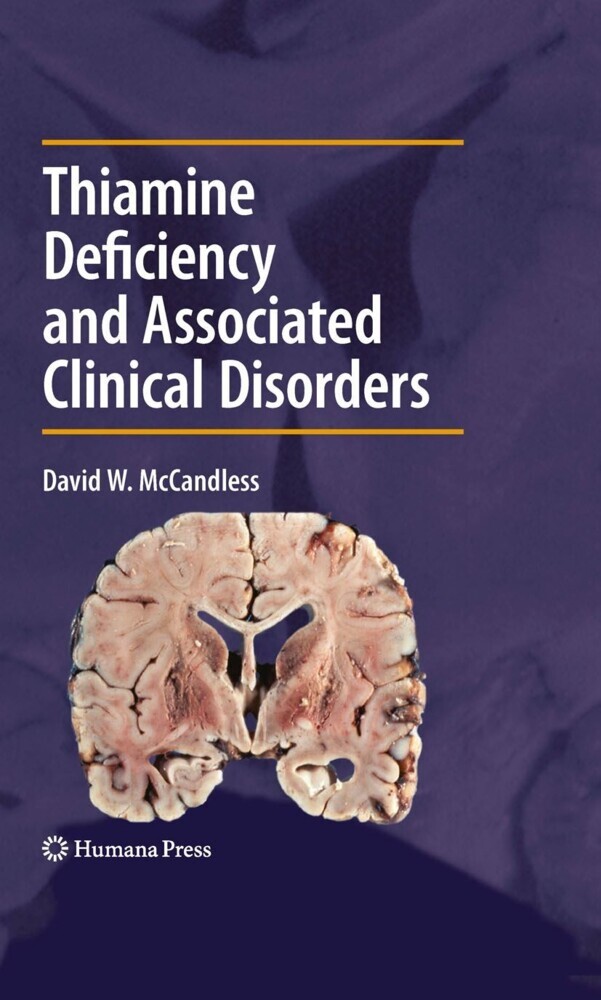 Thiamine Deficiency and Associated Clinical Disorders main product photo