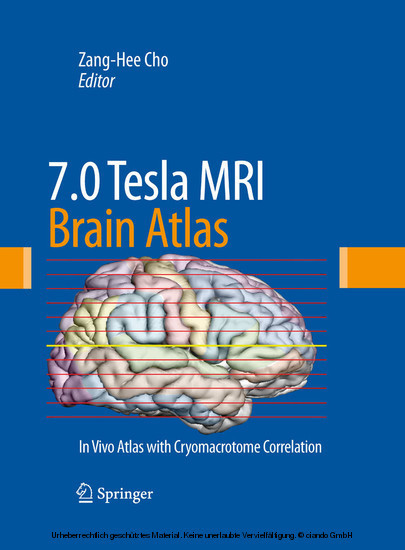 7.0 Tesla MRI Brain Atlas main product photo