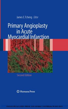 Primary Angioplasty in Acute Myocardial Infarction