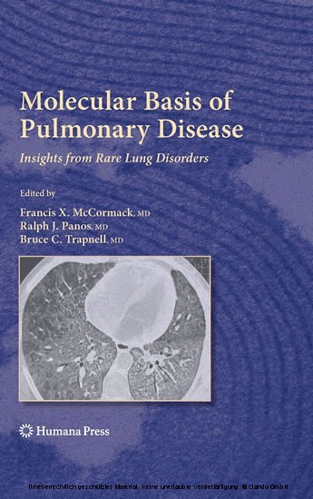 Molecular Basis of Pulmonary Disease main product photo
