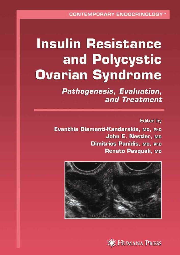 Insulin Resistance and Polycystic Ovarian Syndrome main product photo