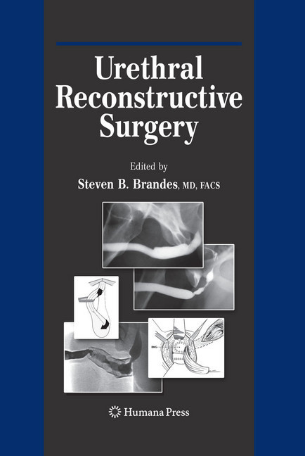 Urethral Reconstructive Surgery main product photo