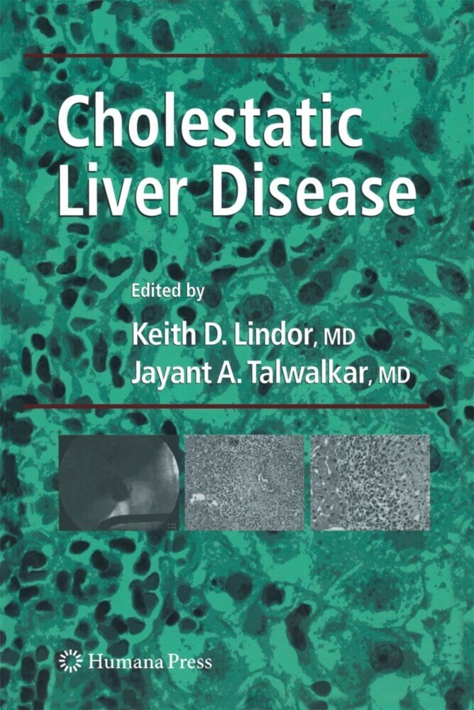 Cholestatic Liver Disease main product photo