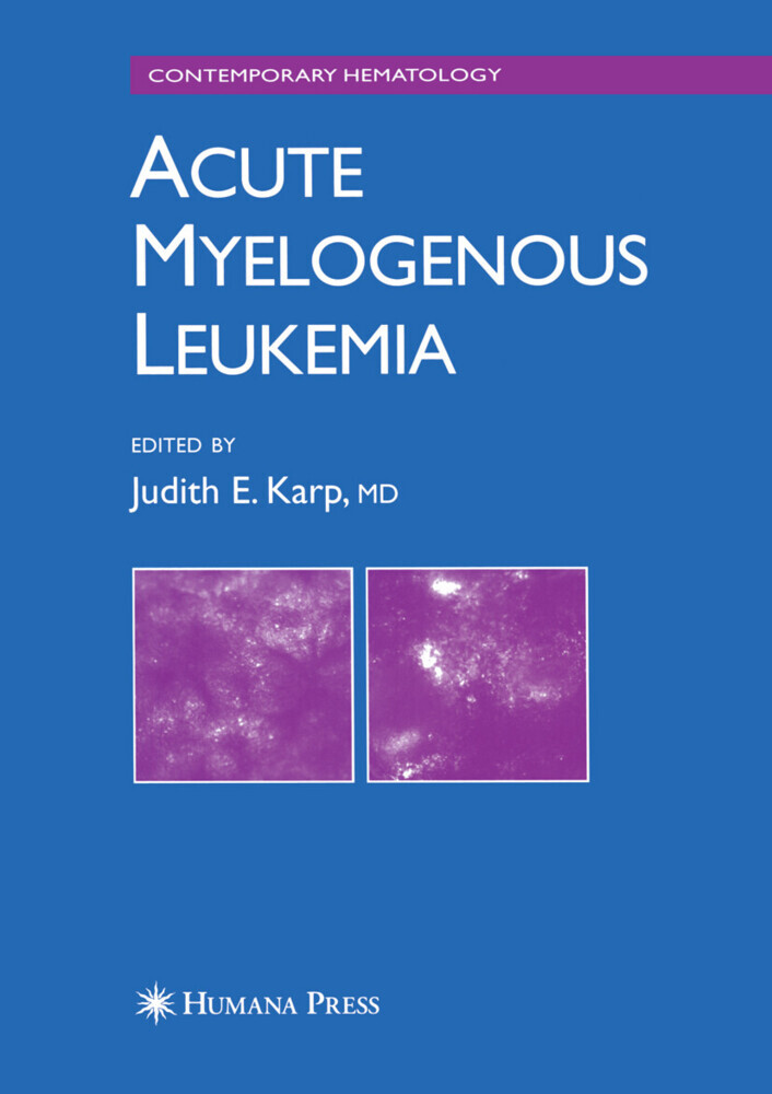 Acute Myelogenous Leukemia main product photo